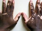 significado real soñar manchas según circunstancias personales