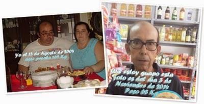 Ver Yo Antes y Ahora