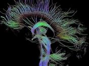 Neuro Psiquiatría Computacoinal