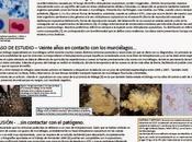 ¿pueden hongos causar problemas espeleólogos?