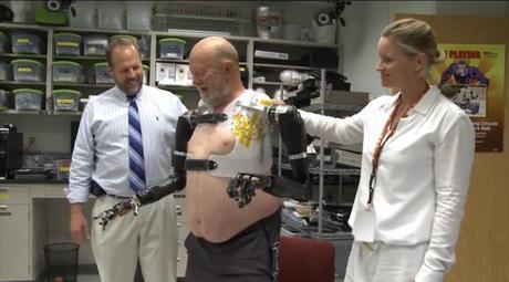 Protesis controladas por la mente