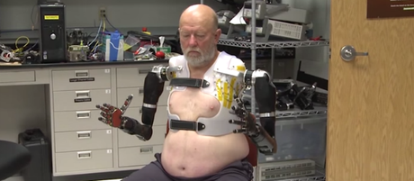 Protesis controladas por la mente