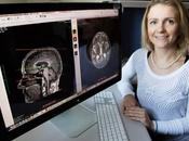 actividad física tercera edad ayuda proteger materia blanca cerebral