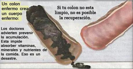 limpieza-de-colon-natural
