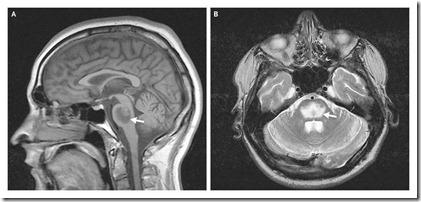 neuroimagen