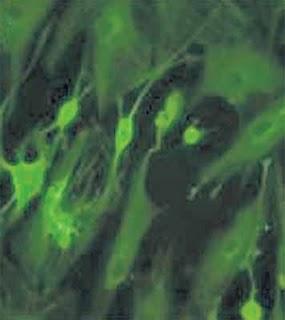 Se cree haber obtenido neuronas a partir de grasa