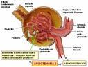 Cirugia para tratar la Hipertension