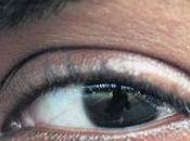 Fasciculaciones, temblores involuntarios