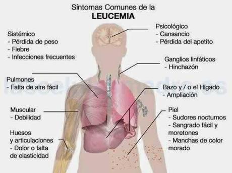 Enfermedades más comunes (Corazón, Vasos Sanguíneos y Sangre) Parte II