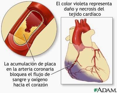 Enfermedades más comunes (Corazón, Vasos Sanguíneos y Sangre) Parte I