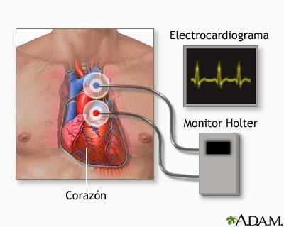 Enfermedades más comunes (Corazón, Vasos Sanguíneos y Sangre) Parte I