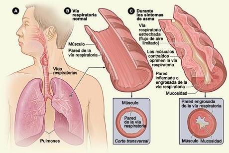 Sistema Respiratorio: Manifestaciones generales