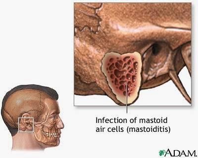 Enfermedades más comunes (Oído, nariz y garganta) Parte I Enfermedades más comunes (Oído, nariz y garganta) Parte I