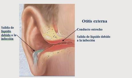 Enfermedades más comunes (Oído, nariz y garganta) Parte I