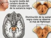 Enfermedades: PARKINSON