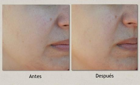 “Perfect White” – la nueva mascarilla iluminadora de FACIALDERM