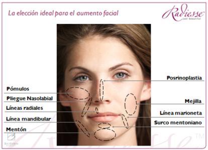 REJUVENECIMIENTO FACIAL SIN CIRUGIA