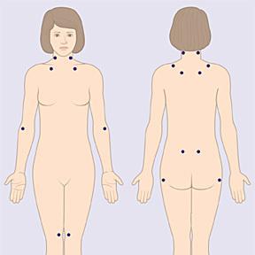 La relación entre la Fibromialgia y los problemas de la tiroides 18 Artricenter