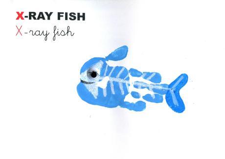 X-RAY FISH