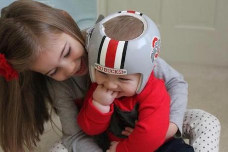 casco plagiocefalia bebe rugby