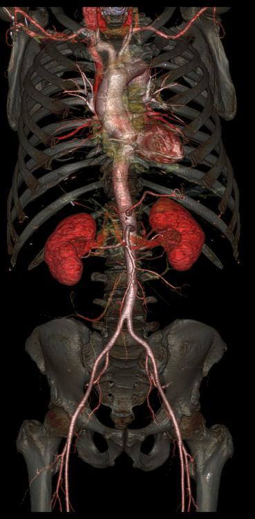 Imágenes del cuerpo humano captadas con tomografía computarizada