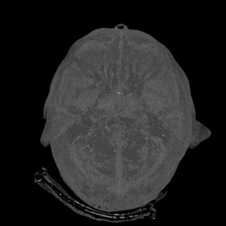 Imágenes del cuerpo humano captadas con tomografía computarizada