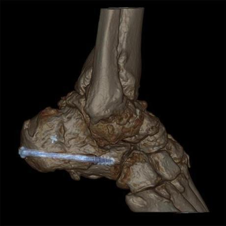 Imágenes del cuerpo humano captadas con tomografía computarizada