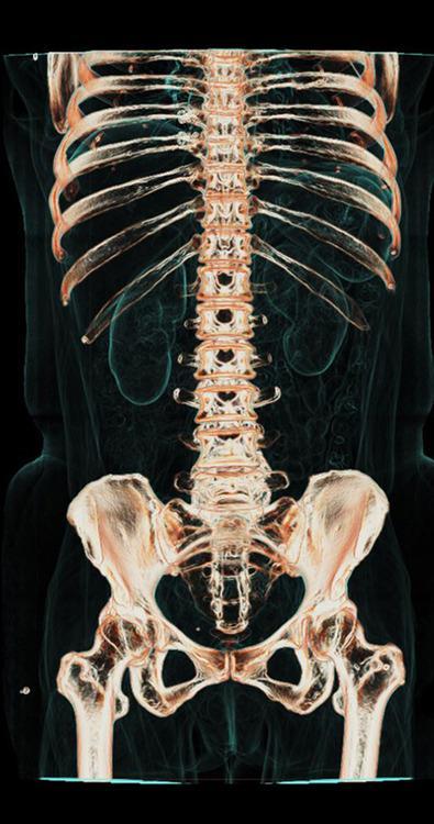 Imágenes del cuerpo humano captadas con tomografía computarizada