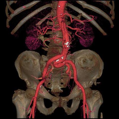 Imágenes del cuerpo humano captadas con tomografía computarizada