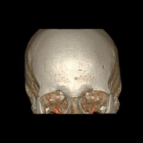 Imágenes del cuerpo humano captadas con tomografía computarizada