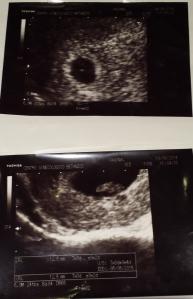ecografias5y8semanas