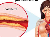 colesterol, aprende como funciona