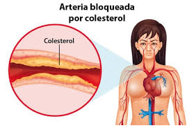 colesterol