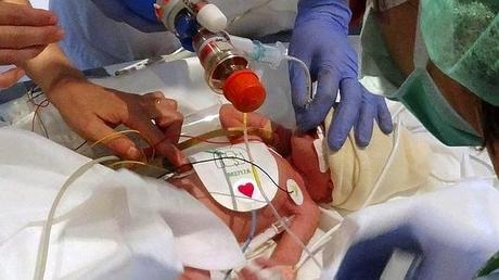 Primer marcapasos biológico