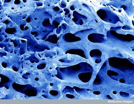 Células madre de hueso y cartílago