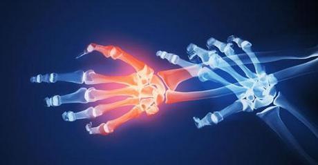 Células madre de hueso y cartílago