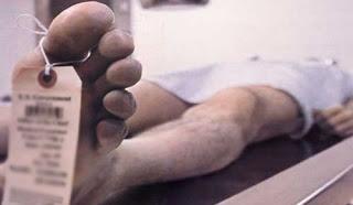 Todo sobre la anestesia para la rinoplastía [2]