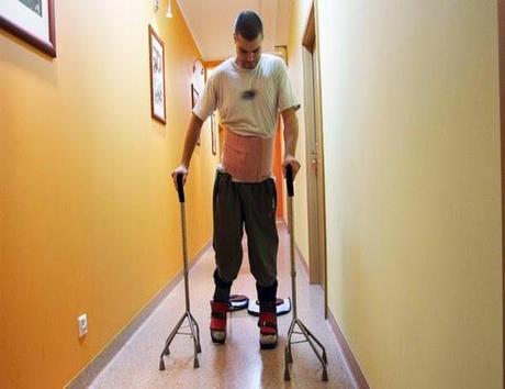 Parapléjico vuelve a caminar tras trasplante de células olfativas