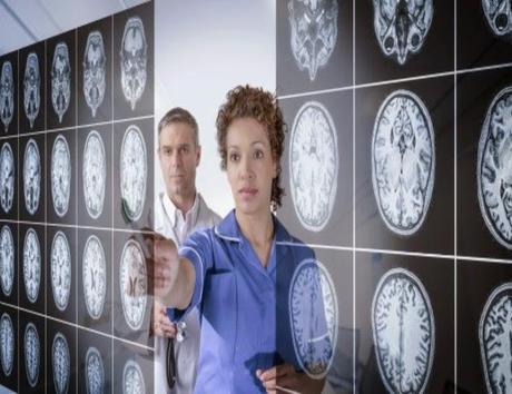 Grasas afectan de forma diferente al cerebro masculino y femenino