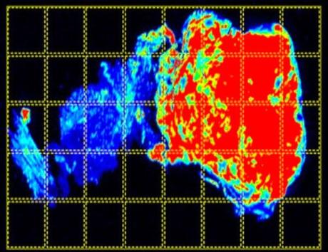 Veneno de escorpión para localizar tumores