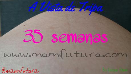 A Vista de Tripa XXXI