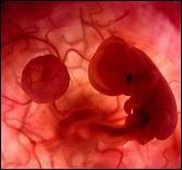 Desarrollo embrionario