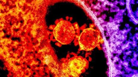 Descubren que media humanidad porta virus desconocido Descubren que media humanidad porta virus desconocido