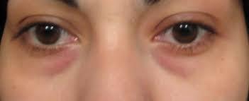 Los efectos del desvelo en el cuerpo humano y la belleza