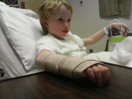 Ibuprofeno, y no morfina, para fracturas en niños