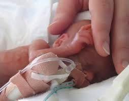 Deficit de vitamina D: aumenta riesgo de nacimiento prematuro