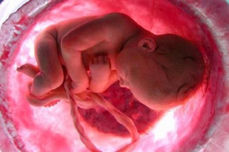 ¿Defectos del tubo neural y la espina bífida Disminuyen?