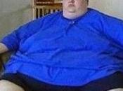 Sistema inmunitario podría desempeñar obesidad