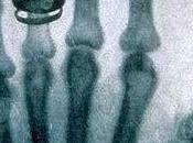 ACONTECIMIENTO: Como descubren "Rayos