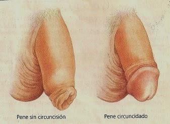 Acucullofilia: ¿Es mejor Sin?